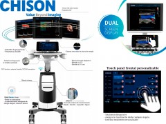 Máy siêu âm 4d giá bao nhiêu ? Các model bán chạy nhất hiện nay