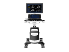 Các công ty phân phối máy siêu âm Chison tại Việt Nam