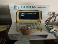 Máy siêu âm đầu tiên ở việt nam