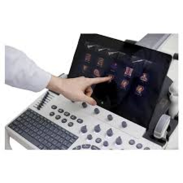 Máy siêu âm Sonoscape S55