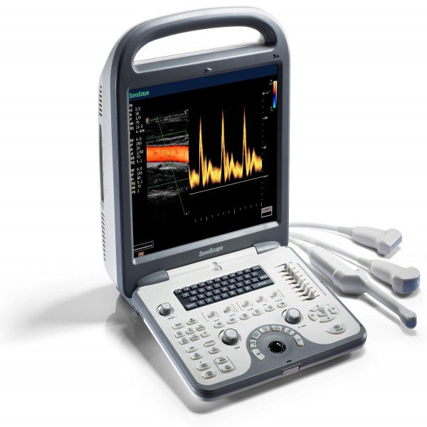 Máy siêu âm 4d Sonoscape S6 xách tay cao cấp